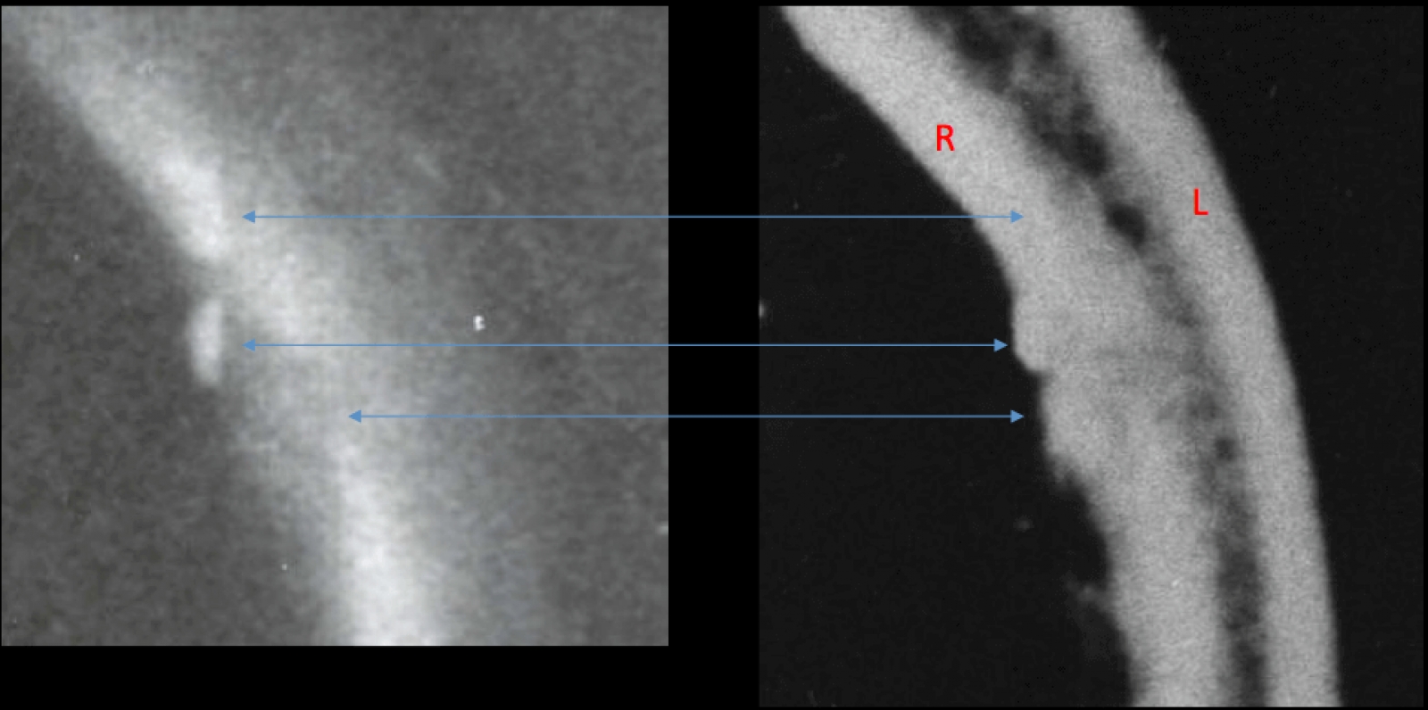 The Application of Forensic Principles for the Analysis of the Autopsy Skull X-Rays of President Kennedy and a Review of the Brain Photographs